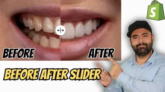 Image related to how to add before and after slider to shopify?